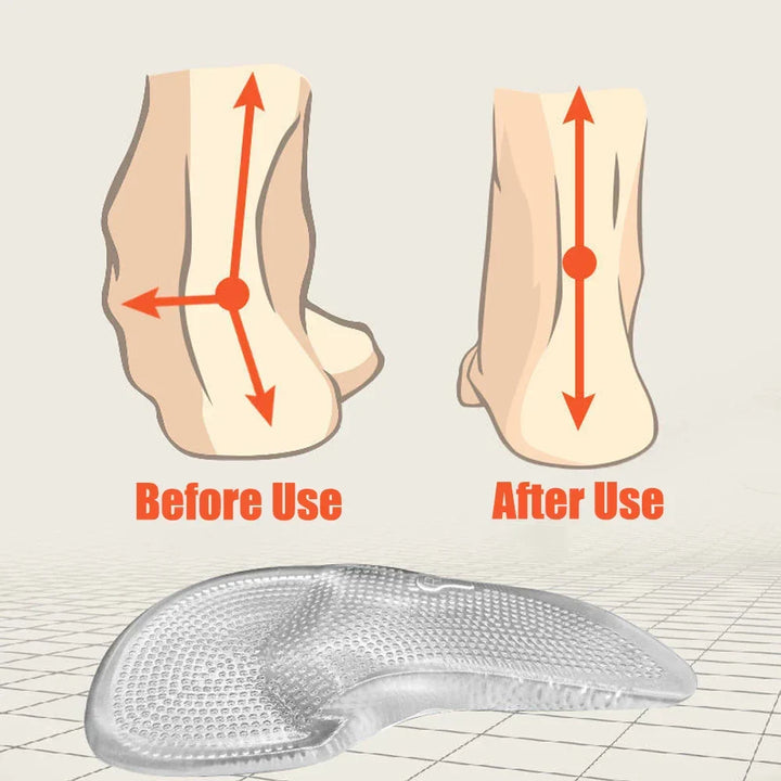 Silicone Gel Orthopaedic Insoles | Cushioned Arch Support